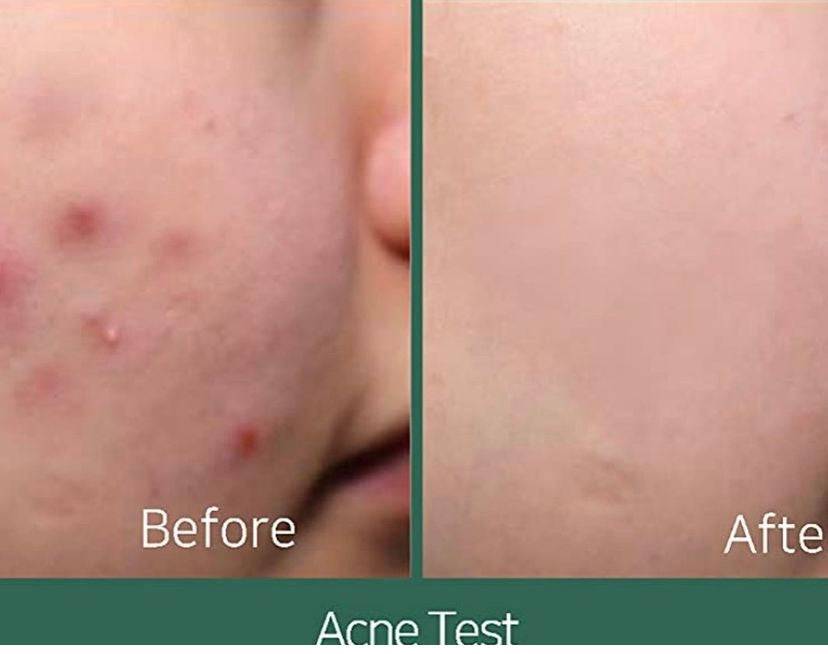 SOME BY MI AHA BHA PHA 30 Days Miracle Cream - 60ml - Inspired by Minana