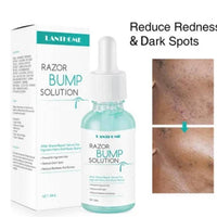 Razor Bump solution, After Shave 30 ml - Inspired by Minana
