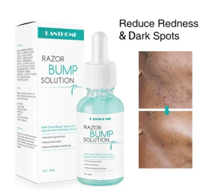 Razor Bump solution, After Shave 30 ml