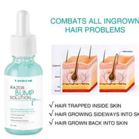 Razor Bump solution, After Shave 30 ml - Inspired by Minana